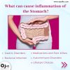 causes-of-inflammation-of-stomach
